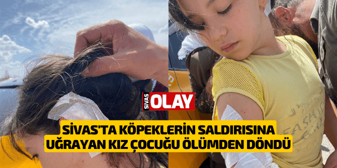 Sivas’ta köpeklerin saldırısına uğrayan kız çocuğu ölümden döndü